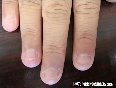 剪指甲、挖耳屎，这些日常小动作竟隐藏大危害！ - 昌吉生活资讯 - 昌吉28生活网 changji.28life.net